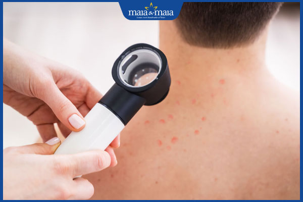 bác sĩ thăm khám mụn lưng