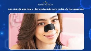 bao lâu lột mụn cám 1 lần