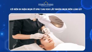 có nên đi nặn mụn ở spa