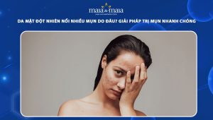 da mặt đột nhiên nổi nhiều mụn