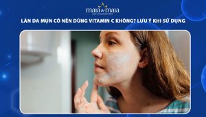 da mụn có nên dùng vitamin c