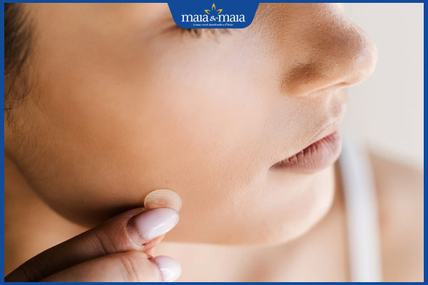 dán miếng dán mụn