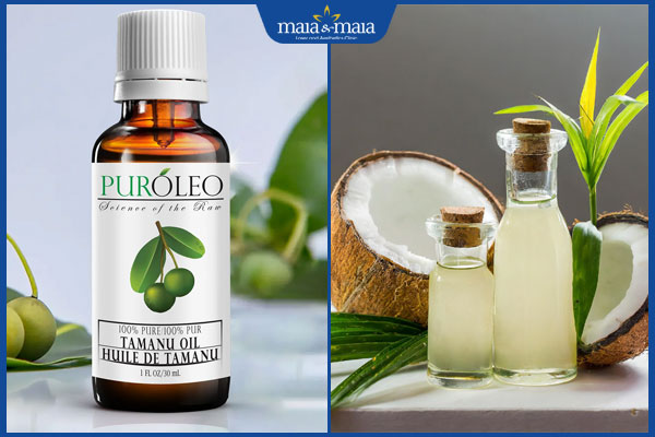 TOP 4 công thức trị mụn bằng dầu mù u lành tính cho làn da 3 dầu mù u và dầu dừa