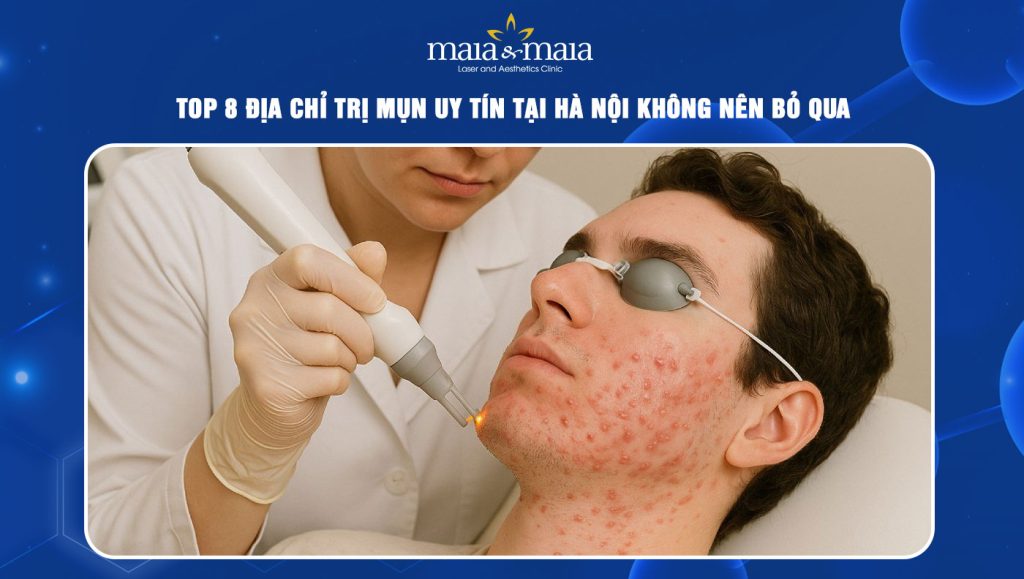 TOP 8 địa chỉ trị mụn uy tín tại Hà Nội không nên bỏ qua 1 địa chỉ trị mụn