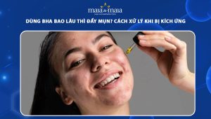 dùng bha bao lâu thì đẩy mụn