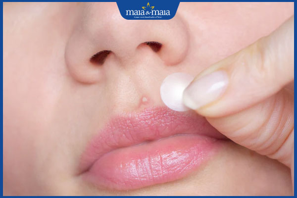 Tác hại của miếng dán mụn là gì? Lưu ý sử dụng đúng cách 2 hiệu quả từ miếng dán mụn