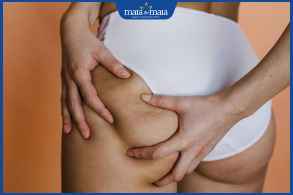 Mụn nhọt ở mông có đặc điểm gì? Cách điều trị hiệu quả 3 không nặn mụn nhọt ở mông