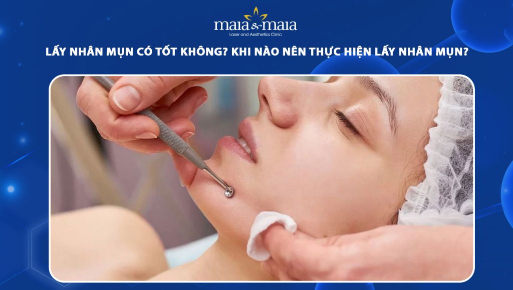 lấy nhân mụn