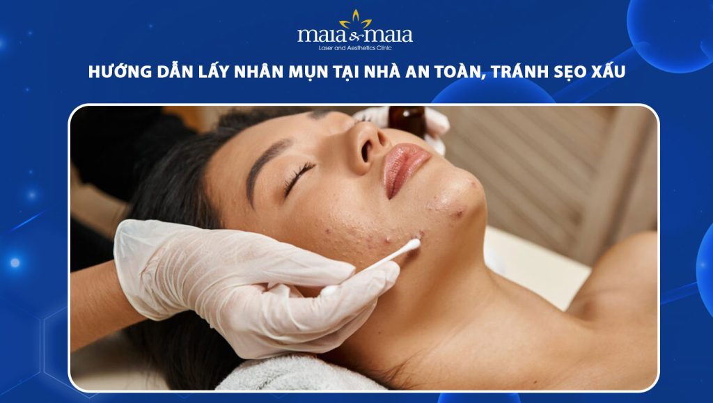 lấy nhân mụn tại nhà