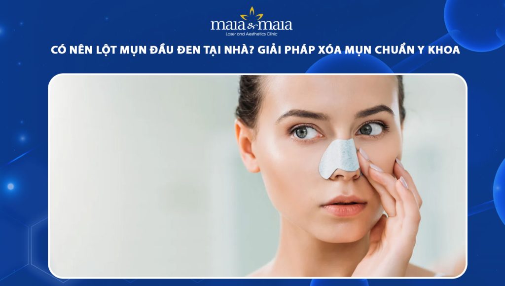 Có nên lột mụn đầu đen tại nhà? Giải pháp xóa mụn hiệu quả 1 lột mụn đầu đen