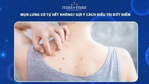 mụn lưng có tự hết không