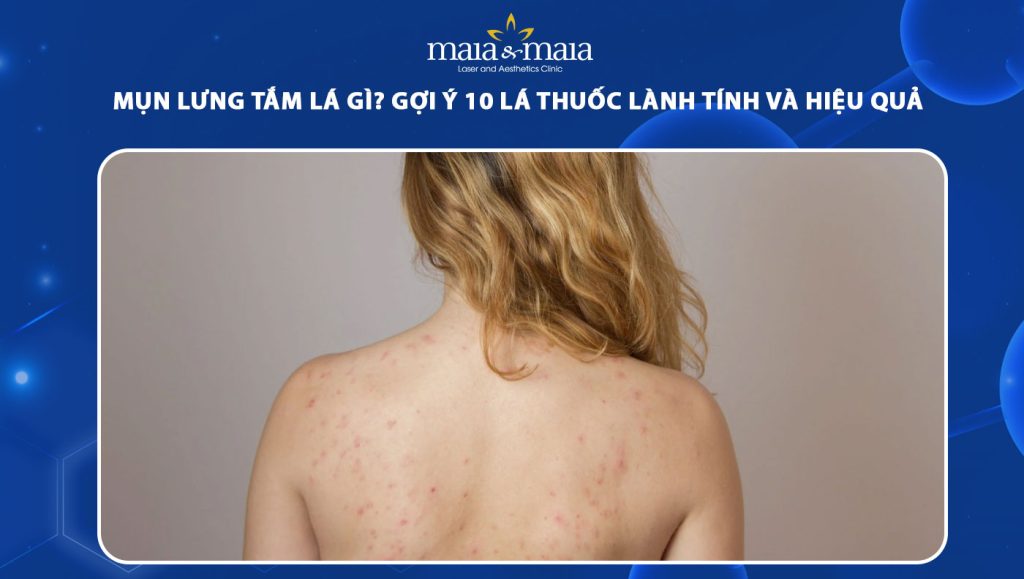 mụn lưng tắm lá gì