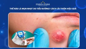 mụn nhọt do tiểu đường
