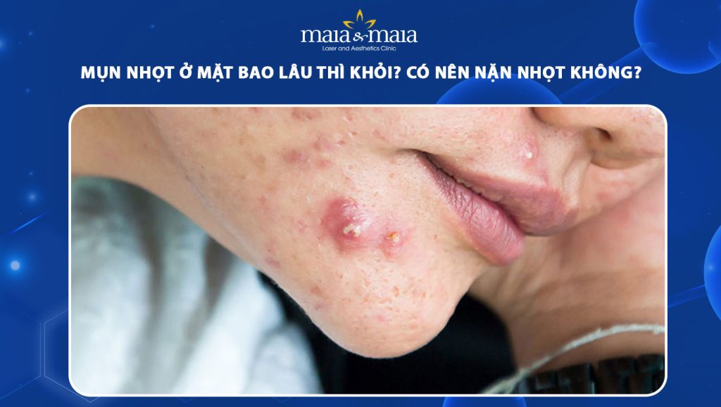 mụn nhọt ở mặt