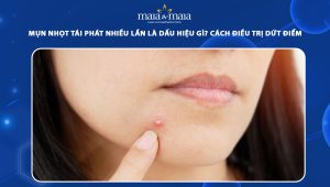 mụn nhọt tái phát nhiều lần