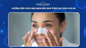 nặn mụn đầu đen ở mũi