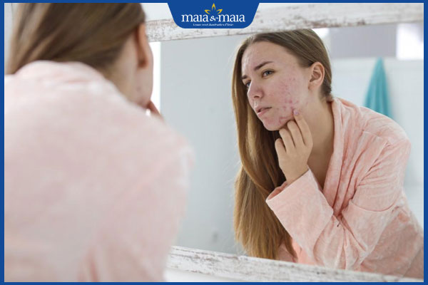 nổi mụn trên mặt
