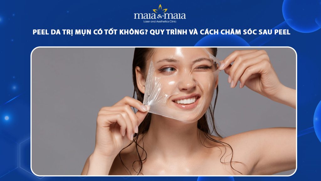 Peel da trị mụn có tốt không? Quy trình và chăm sóc sau peel 1 peel da trị mụn