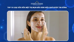 sữa rửa mặt trị mụn đầu đen