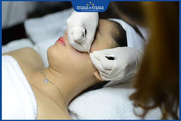 thực hiện lấy nhân mụn bằng tăm bông