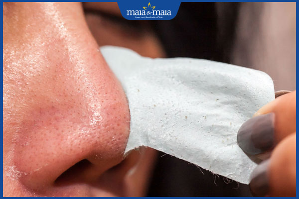 Có nên lột mụn đầu đen tại nhà? Giải pháp xóa mụn hiệu quả 2 thực hiện lột mụn đầu đen