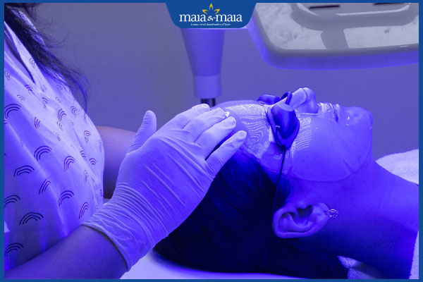 thực hiện trị mụn bằng ánh sáng elight