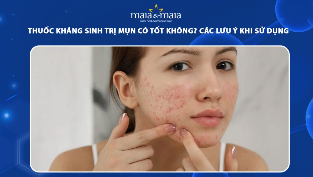 Thuốc kháng sinh trị mụn có tốt không? Lưu ý khi sử dụng 1 thuốc kháng sinh trị mụn