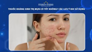 thuốc kháng sinh trị mụn