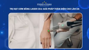 trị hạt cơm bằng laser co2