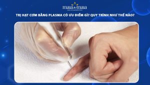 trị hạt cơm bằng plasma