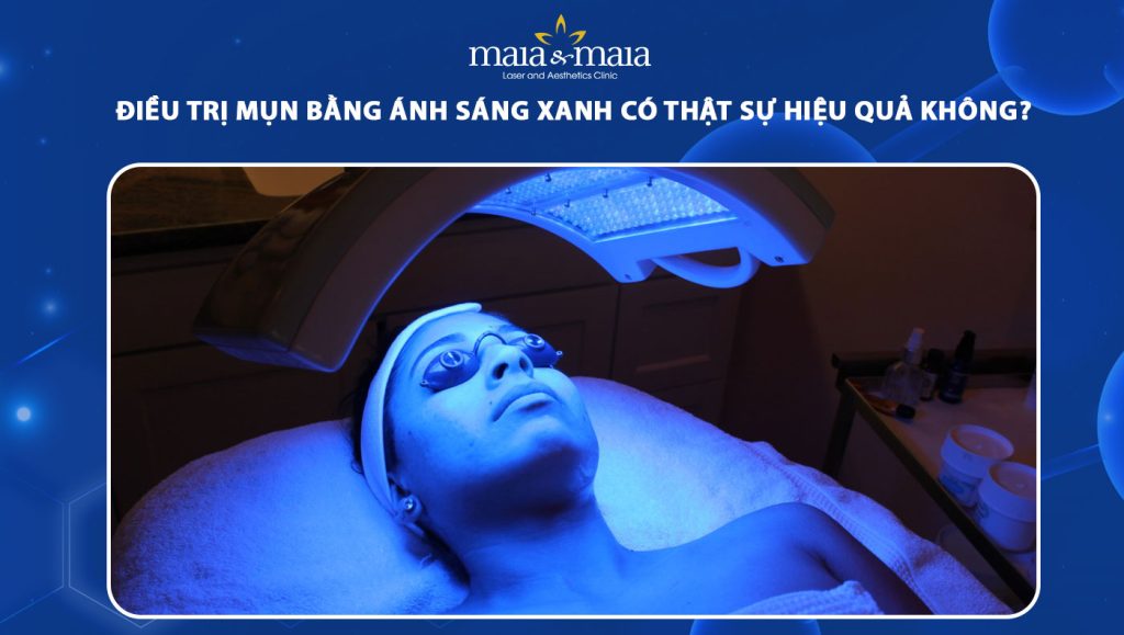 Điều trị mụn bằng ánh sáng xanh có thật sự hiệu quả không? 1 trị mụn bằng ánh sáng xanh