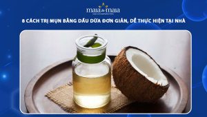 trị mụn bằng dầu dừa