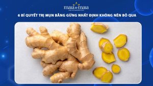 trị mụn bằng gừng