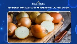 trị mụn bằng hành tây