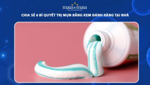 trị mụn bằng kem đánh răng