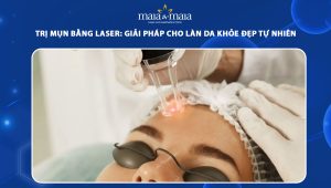 trị mụn bằng laser