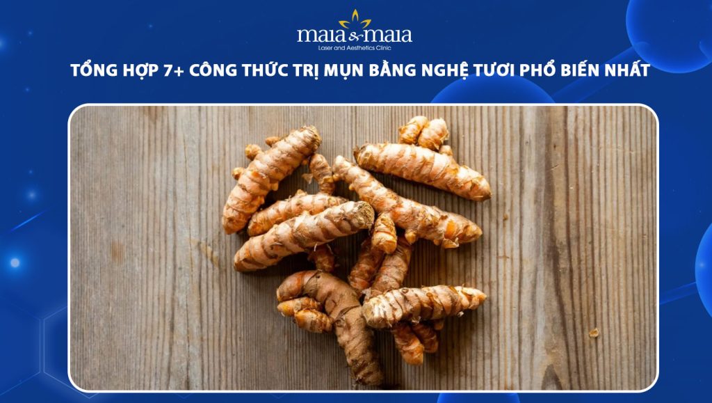 trị mụn bằng nghệ tươi