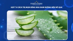 trị mụn bằng nha đam