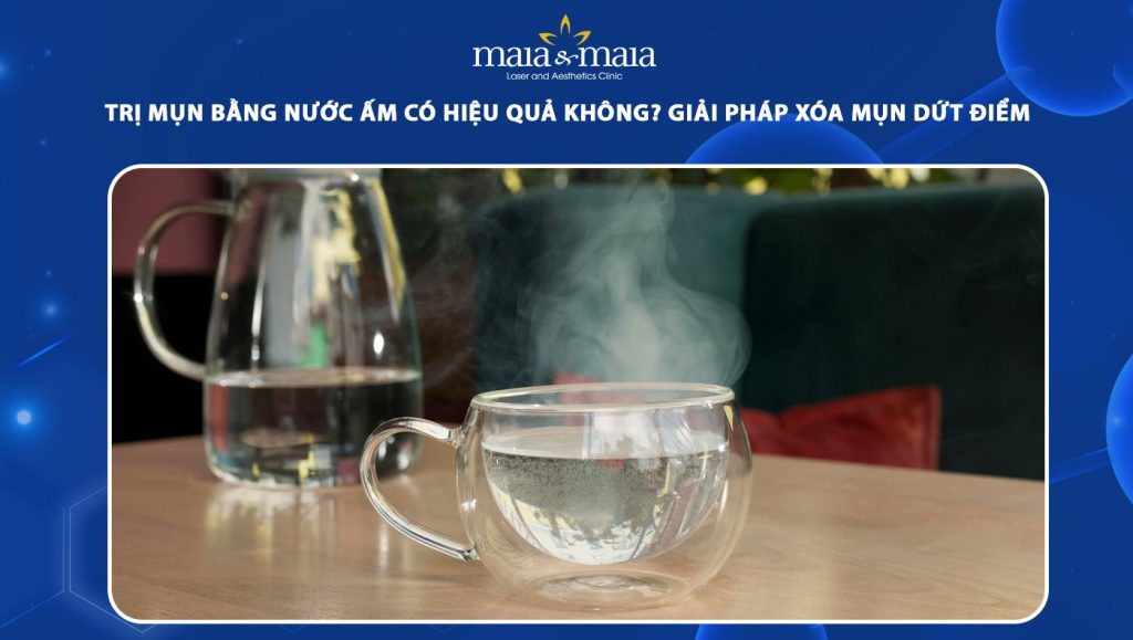 Trị mụn bằng nước ấm hiệu quả không? Cách xóa mụn dứt điểm 1 trị mụn bằng nước ấm