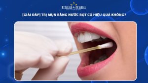 trị mụn bằng nước bọt