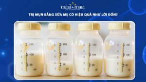 trị mụn bằng sữa mẹ
