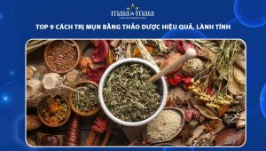 trị mụn bằng thảo dược