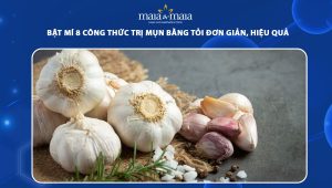 trị mụn bằng tỏi