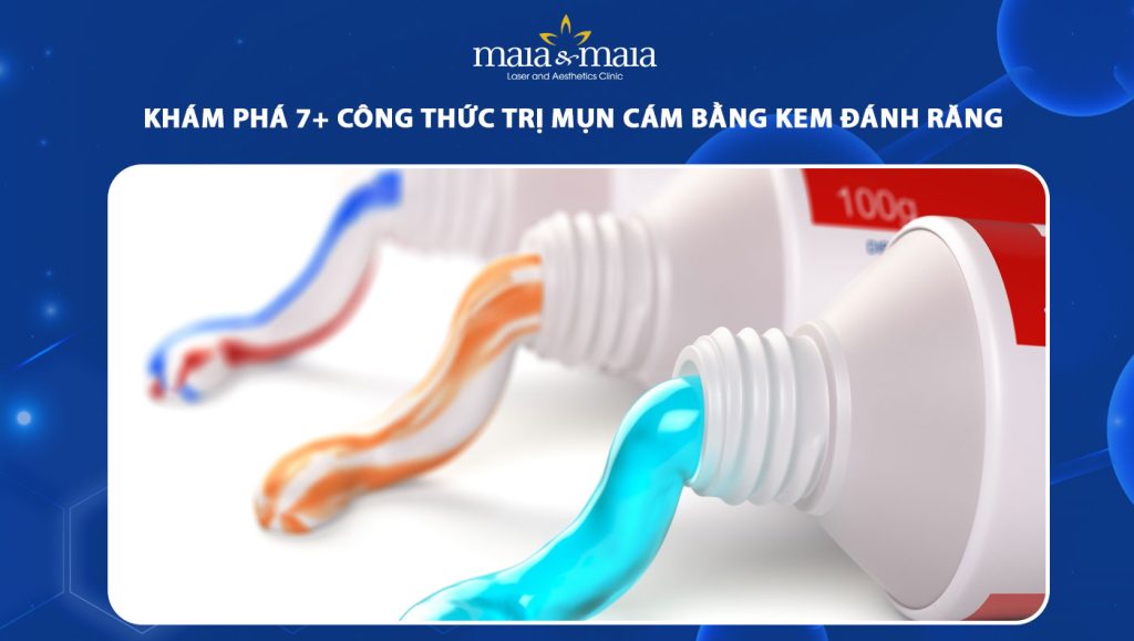 trị mụn cám bằng kem đánh răng