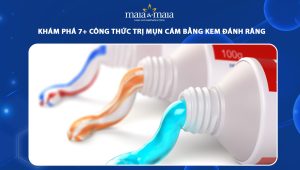 trị mụn cám bằng kem đánh răng