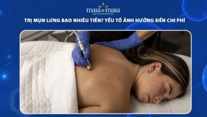 trị mụn lưng bao nhiêu tiền