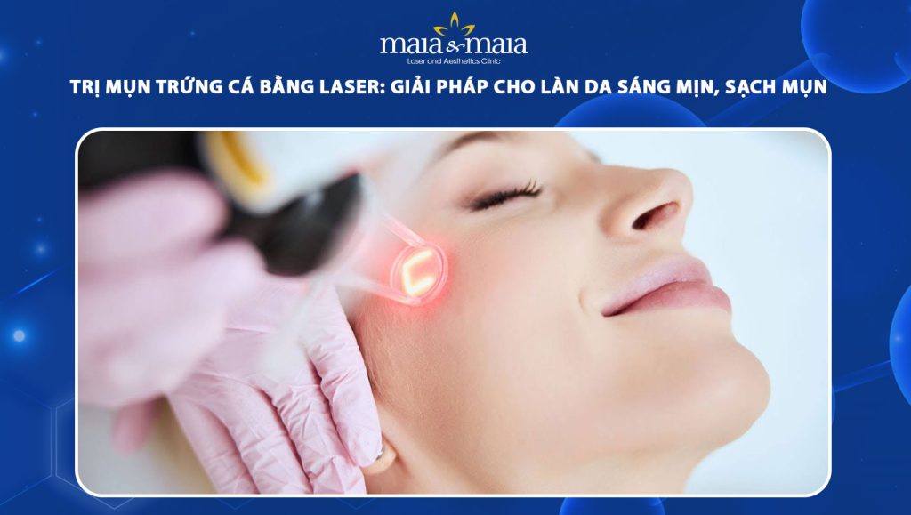 trị mụn trứng cá bằng laser