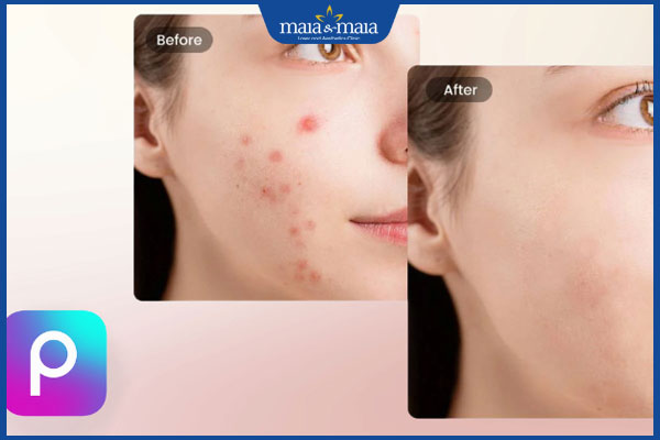 10 app xóa mụn miễn phí chỉnh sửa ảnh siêu hiệu quả hiện nay 4 xóa mụn bằng picsart