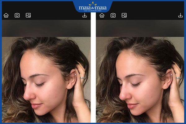 10 app xóa mụn miễn phí chỉnh sửa ảnh siêu hiệu quả hiện nay 7 xóa mụn bằng airbrush