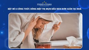 xông mặt trị mụn đầu đen